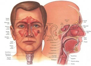 sinusitis causes