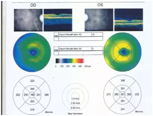 csr eye ayurvedic treatment