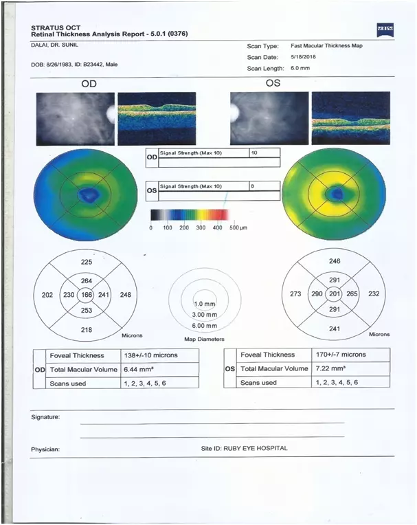 csr eye ayurvedic treatment