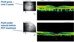 csr eye management