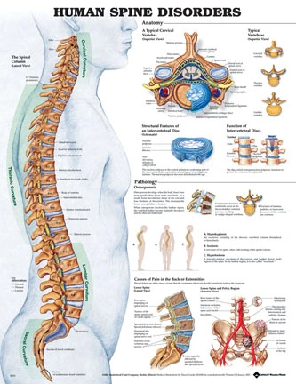 Spine diseases